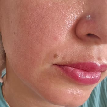 Watsons Micellar Temizleme Suyu Cildimde Yanma Ve Tahrişe Sebep Oldu