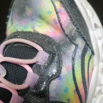 Skechers Kısa Sürede Yırtılan Çocuk Ayakkabısına Değişim Reddi Hayal Kırıklığı Yarattı