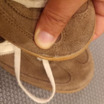 Adidas Ayakkabıda Hızlı Açılma Ve İlgisiz Servis