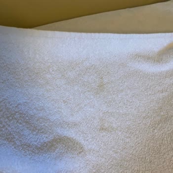 Hijyen Sorunları Nedeniyle Otelden Erken Çıkış Ve İade Talebi