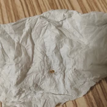 Çankırı KYK Erkek Öğrenci Yurdu’nda Hijyen ve Barınma Sorunları Öğrencileri Mağdur Ediyor