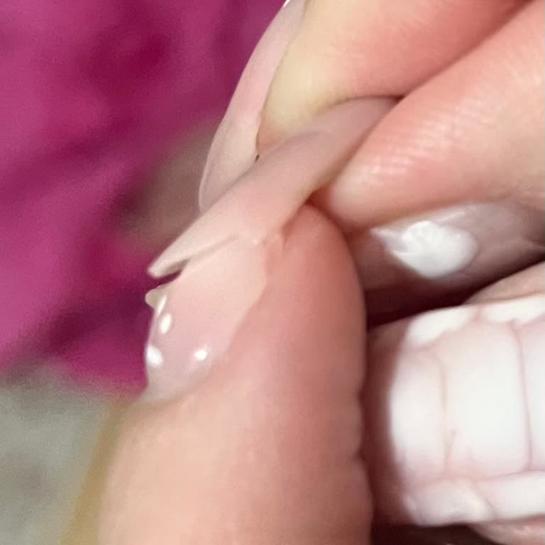 Jel Tırnak Bakımı Sonrası Sağlık Sorunu Ve Mağduriyet