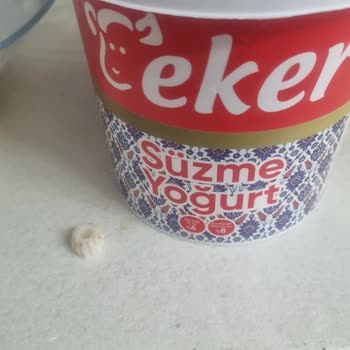 Eker Süzme Yoğurtta Yabancı Maddeyle Karşılaştım Sağlığım Tehlikeye Girdi