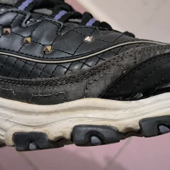 Skechers Ayakkabıda Kısa Sürede Açılma Ve Değişim Talebinin Reddedilmesi