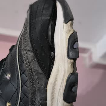 Skechers Ayakkabıda Kısa Sürede Açılma Ve Değişim Talebinin Reddedilmesi