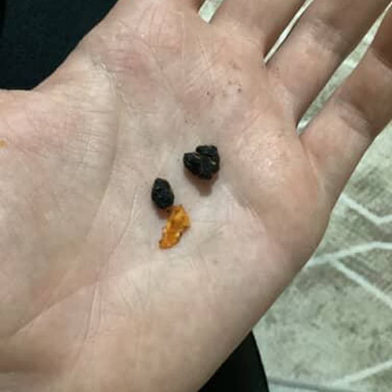 Doritos Paketinde Siyah Maddeyle Karşılaştım, Endişeliyim