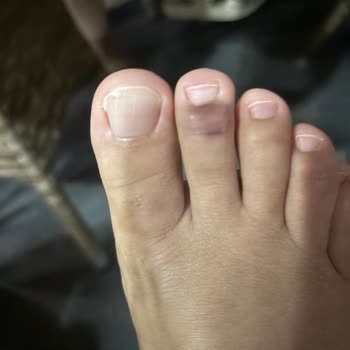 Hijyen Sorunları Ve İlgisizlik Nedeniyle Kâbusa Dönen Tatil