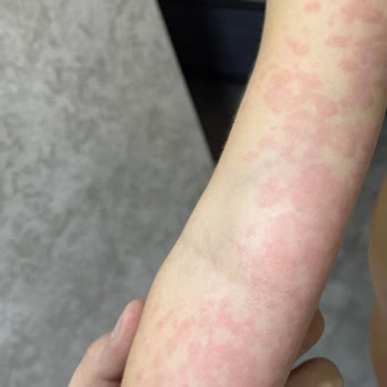 Hijyen Sorunları Ve İlgisizlik Nedeniyle Kâbusa Dönen Tatil