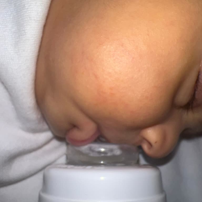 Bebek Yağı Sonrası Oğlumda Ciddi Cilt Kuruluğu Ve Kızarıklık Oluştu