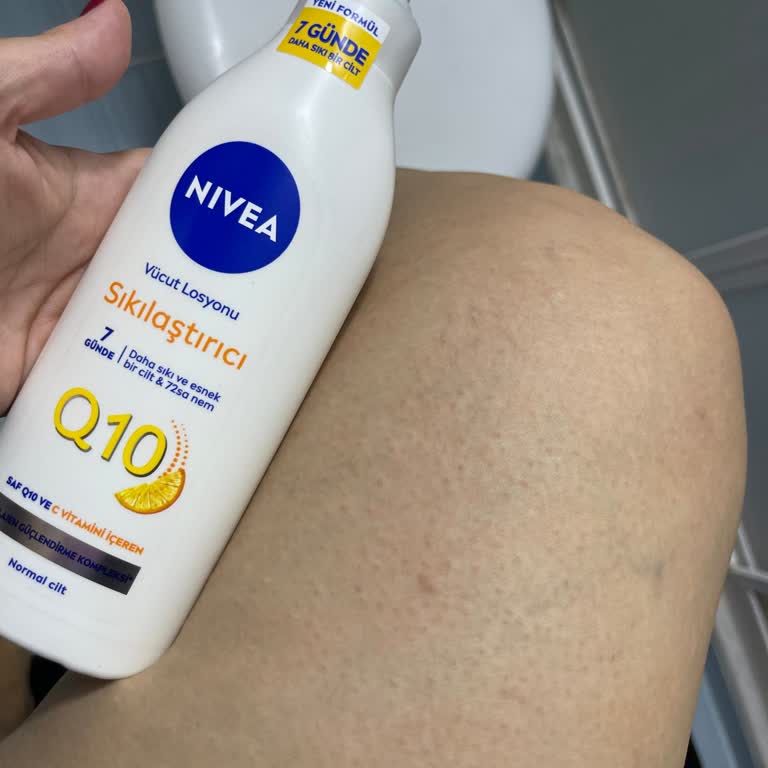 Nivea Losyon Kaşıntı Ve Kabarcık Yaptı, Para İadesi İstiyorum