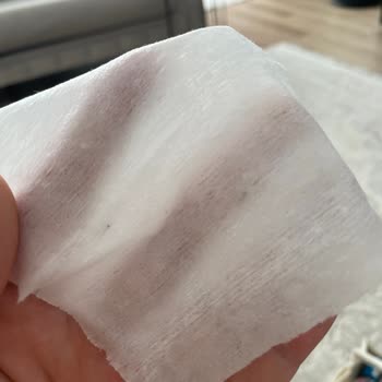 Küflü Islak Mendil Teslimatı: Bebeğim İçin Güven Sorunu Yaşadım