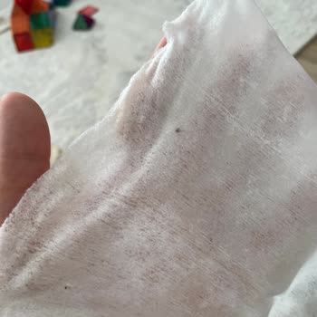 Küflü Islak Mendil Teslimatı: Bebeğim İçin Güven Sorunu Yaşadım