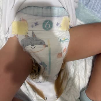 Prima Premium Care: Yüksek Fiyat, Düşük Kalite Hayal Kırıklığı