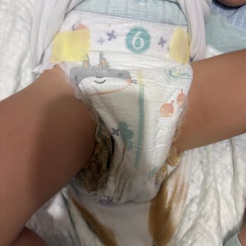 Prima Premium Care: Yüksek Fiyat, Düşük Kalite Hayal Kırıklığı