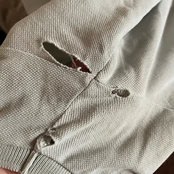 Mavi T-shirtte Dikiş Sökülmesi Ve Kumaş Yırtılması Sorunu