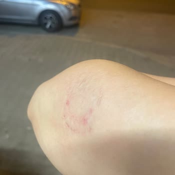 Personel Tarafından Fiziksel Müdahale Ve Hakaret Mağaza Yönetimi İlgisiz Kaldı