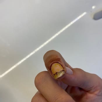 Flow Tırnak Bakım Ve Güzellik Sağlık Sorunları Ve İlgisizlik!