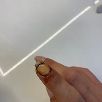 Flow Tırnak Bakım Ve Güzellik Sağlık Sorunları Ve İlgisizlik!