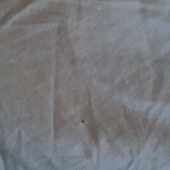 Aynı Sorun Tekrarlandı: Defolu Ve Kirli Ürün Teslimatı