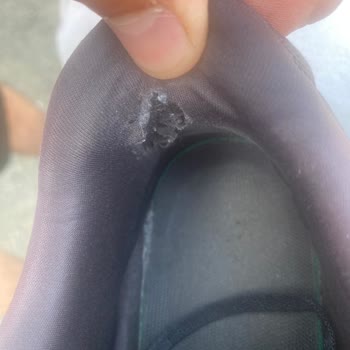 Adidas Ayakkabının Kısa Sürede Yırtılması Ve Mağaza İncelemesinde Kusur Bulunmaması