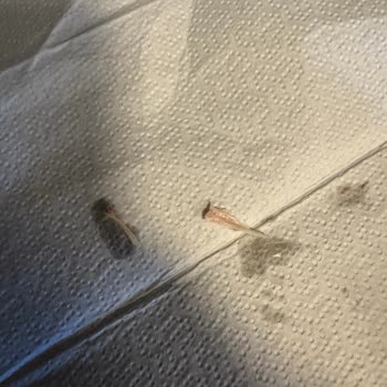 Ton Balığı Konservesinde Kılçık Çıkması Nedeniyle Yaşanan Mağduriyet