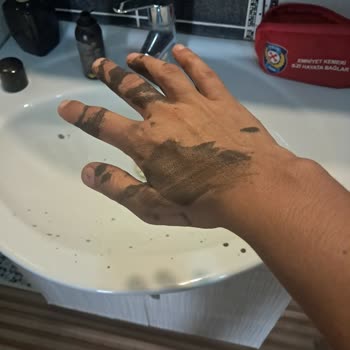 Arızalı Saç Kapatıcı Ürün Nedeniyle Maddi Ve Manevi Zarar