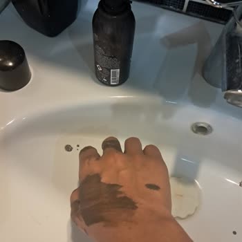 Arızalı Saç Kapatıcı Ürün Nedeniyle Maddi Ve Manevi Zarar