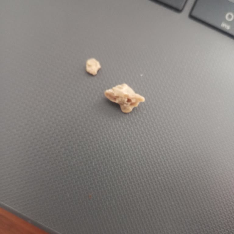 A101 Ovadan Pirinçten Çıkan Maddeler