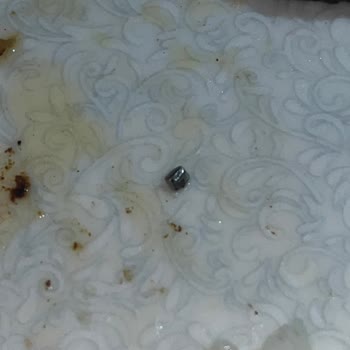 Migros'tan Aldığım Köftede Metal Parça Çıktı, Dişim Kırıldı Ve Ürün Kalitesi Hayal Kırıklığı Yarattı