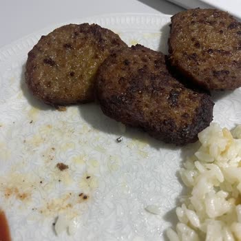 Migros'tan Aldığım Köftede Metal Parça Çıktı, Dişim Kırıldı Ve Ürün Kalitesi Hayal Kırıklığı Yarattı