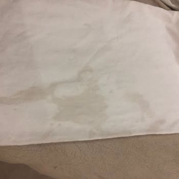 Bir Kez Giyilen Pantolonda Leke Ve Mağazada İlgisizlik