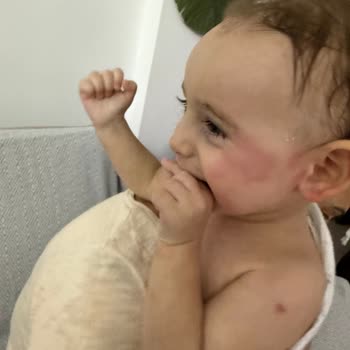 Bebek Losyonunda Ciddi Yan Etkiler Ve Güvenlik Endişesi