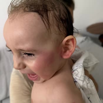 Bebek Losyonunda Ciddi Yan Etkiler Ve Güvenlik Endişesi