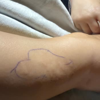 Bebek Losyonunda Ciddi Yan Etkiler Ve Güvenlik Endişesi