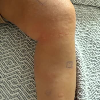 Bebek Losyonunda Ciddi Yan Etkiler Ve Güvenlik Endişesi