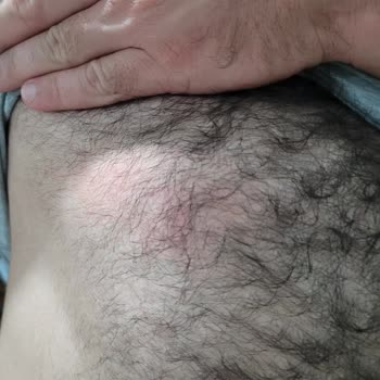 Avşar Soda Şişesi Patladı Cam Parçaları Eşimi Yaraladı