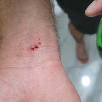 Avşar Soda Şişesi Patladı Cam Parçaları Eşimi Yaraladı