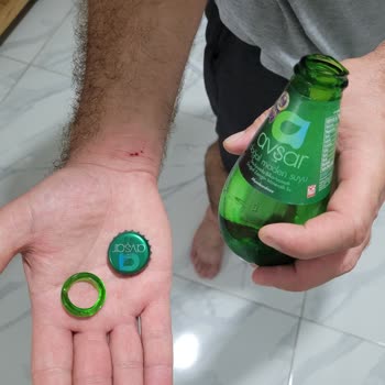 Avşar Soda Şişesi Patladı Cam Parçaları Eşimi Yaraladı