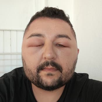 Eki aç