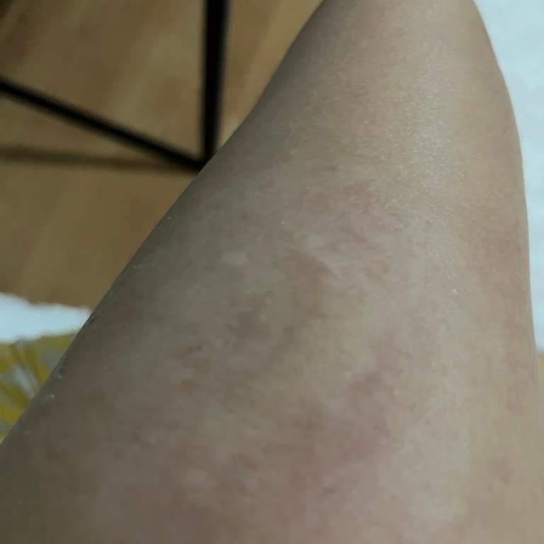 Sibionics Sensörlerinde Kullanım Sorunu Ve Müşteri Hizmetlerinden Yanıtsızlık