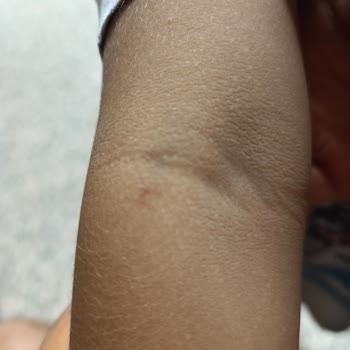 Acil Serviste İlgisiz Ve Yetersiz Müdahale Sonucu Çocuğum Zarar Gördü