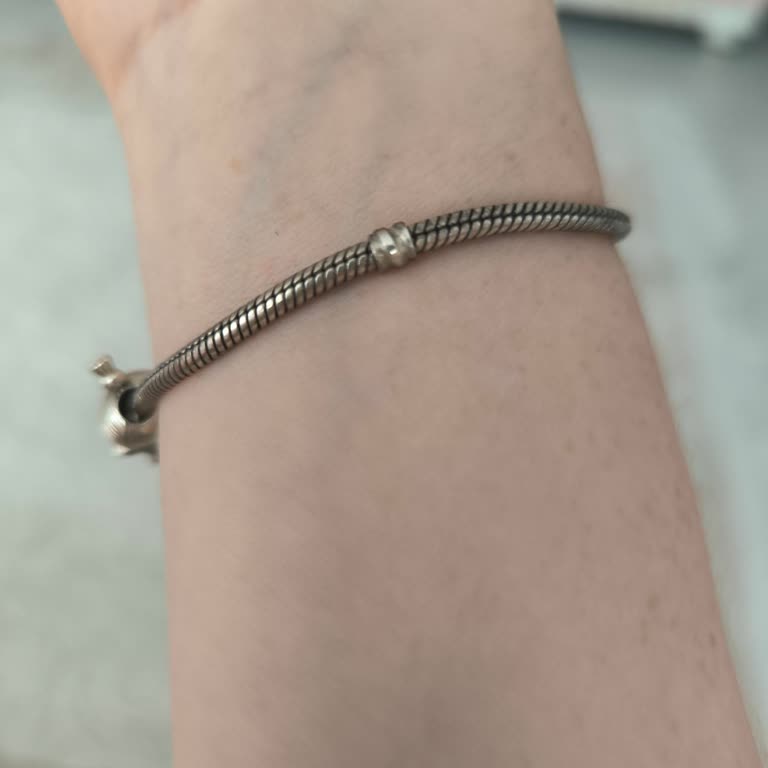 Pandora Bilekliğim Sürekli Kararıyor, Mağaza Yeterli Destek Sunmuyor