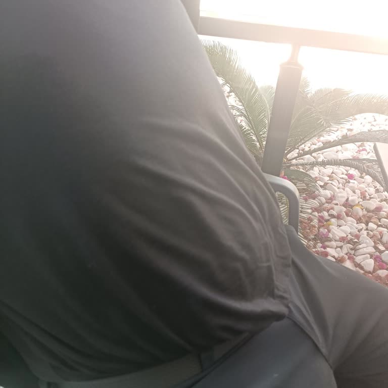 Columbia Tişörtte Renk Solması Ve İki Kez Reddedilen İnceleme Süreci