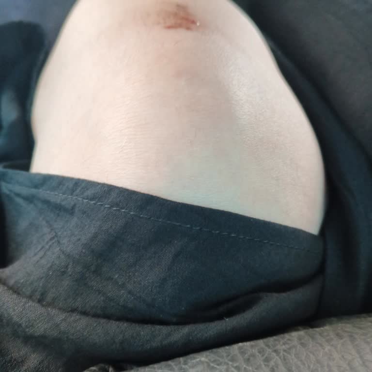 Şoförün Tutumu Ve Mola Eksikliği Yolculuğumu Olumsuz Etkiledi