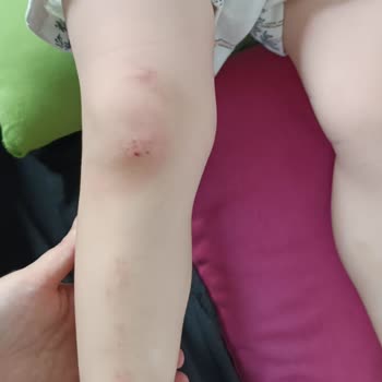 Beyaz Zambak Anaokulu Kurtköy Çocukların Başında Yeterli Öğretmen Gözetimi Yok