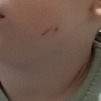 Beyaz Zambak Anaokulu Kurtköy Çocukların Başında Yeterli Öğretmen Gözetimi Yok