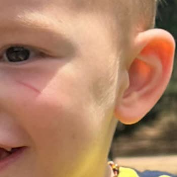 Beyaz Zambak Anaokulu Kurtköy Çocukların Başında Yeterli Öğretmen Gözetimi Yok