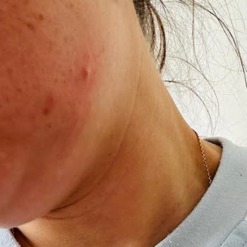 Aldığım Ürünlerde Farklı Koku Ve Cilt Sorunları: Orijinallik Şüphesi Ve İade Talebi