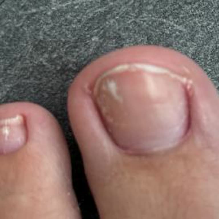 Smç Kuaför Ve Güzellik Salonu Hijyen Sorunu!