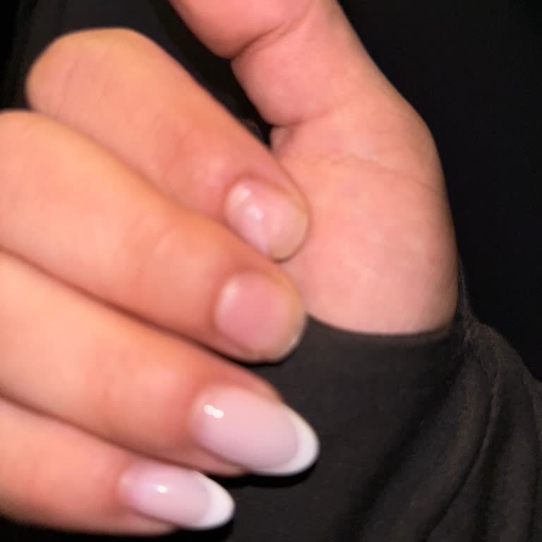 Protez Tırnak Uygulaması Beklenenden Kısa Sürede Kırıldı, Mağduriyetim Giderilmedi